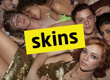 MTVs new show Skins causes controversy